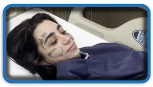 Ana Buldrini Tragic End to a Cosmetic Dream in Turkey