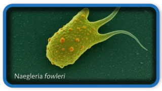 12-Year-Old Dies from Brain-Eating Amoeba