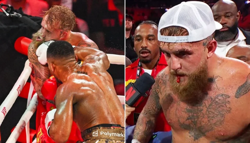 Jake Paul vs Anthony Joshua: Survival, Blood, Broken Jaws